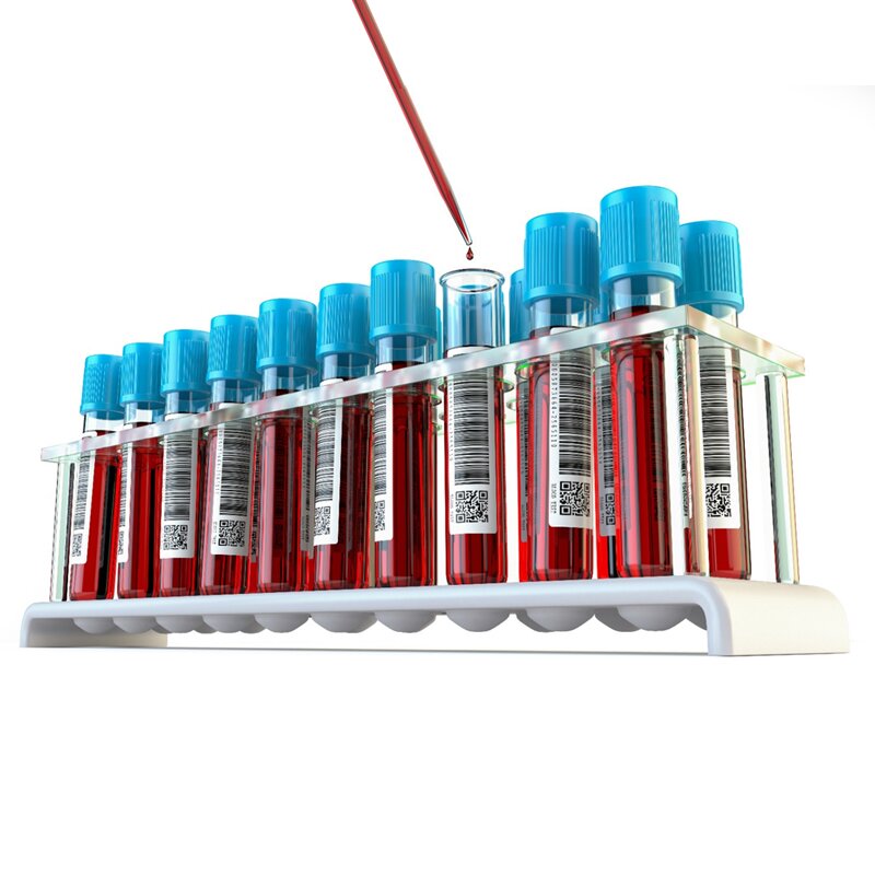 Test Antigen Multiplex